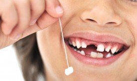 Причины выпадения зубов