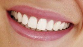 Самые популярные проблемы с зубами